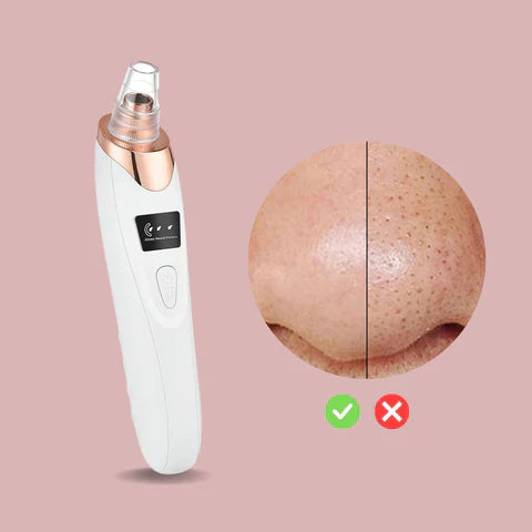 ClearSkinPro™ | Nano-Elektrischer Vakuum-Mitesserentferner — Entfessle deine strahlend klare Haut ohne Schmerzen oder Stress