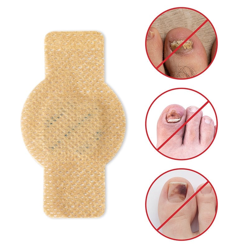 PureNail™  | Optimale Wiederherstellung Ihrer Nägel