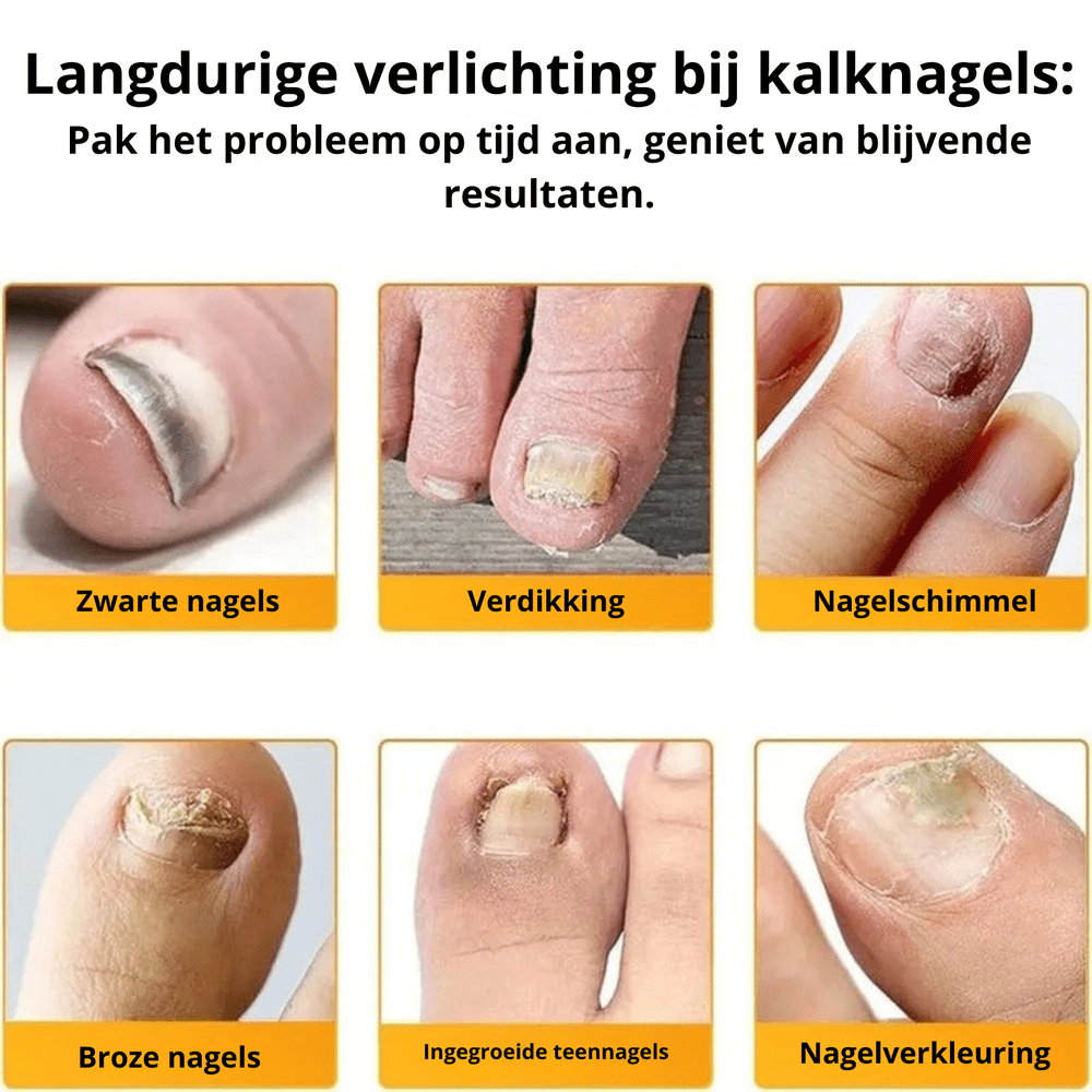 PureNail™  | Optimale Wiederherstellung Ihrer Nägel