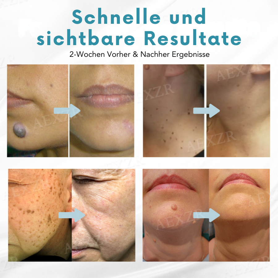 1+1 Gratis | Radiant™ | Schnelle Hautverjüngung [Letzter Tag Rabatt]