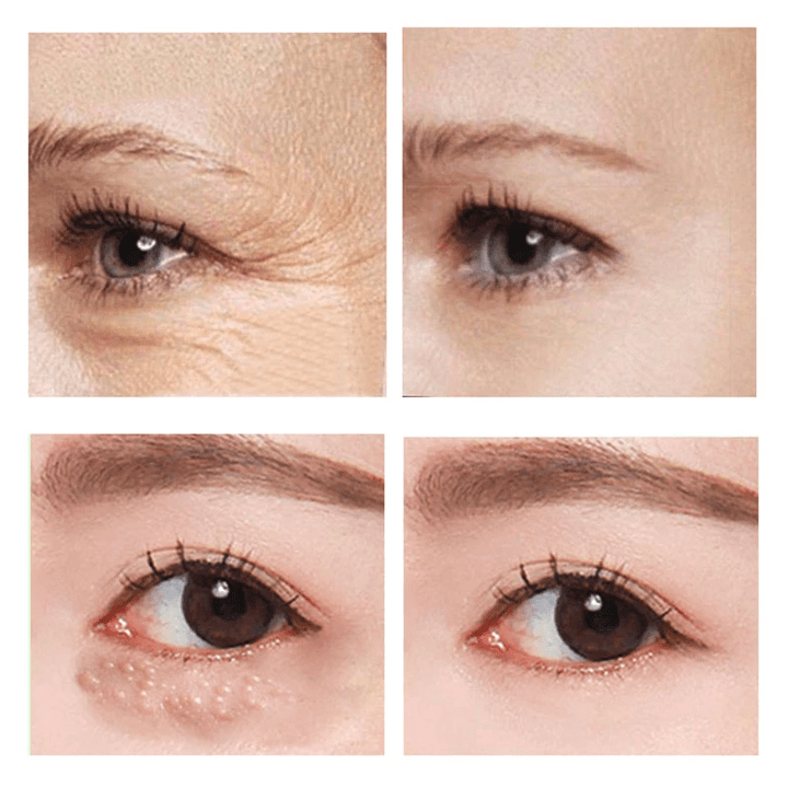 1+1 Gratis | SleekEyes™ | Schnell wirkende straffende Augencreme