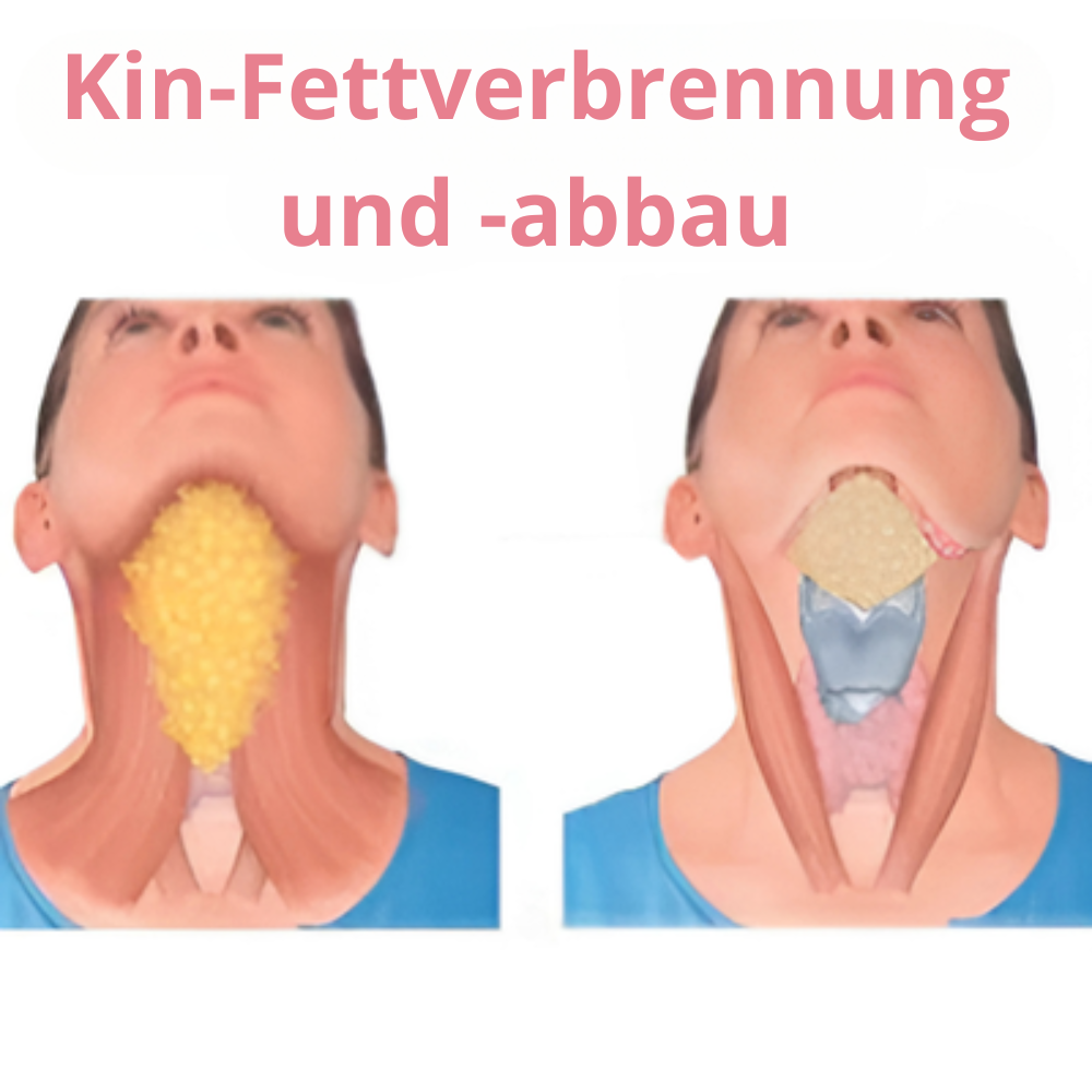 2+1 GRATIS | JawDefine™ | Verabschieden Sie sich von Ihrem Doppelkinn