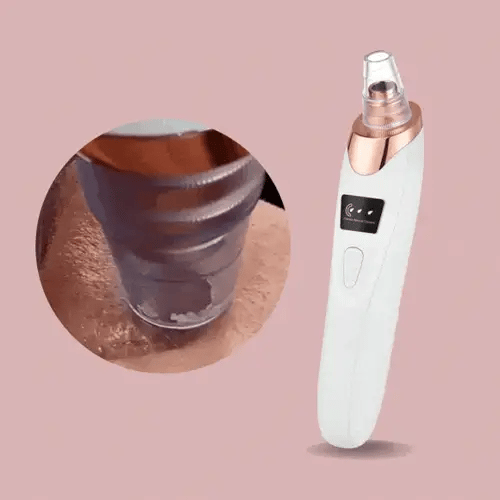 ClearSkinPro™ | Nano-Elektrischer Vakuum-Mitesserentferner — Entfessle deine strahlend klare Haut ohne Schmerzen oder Stress